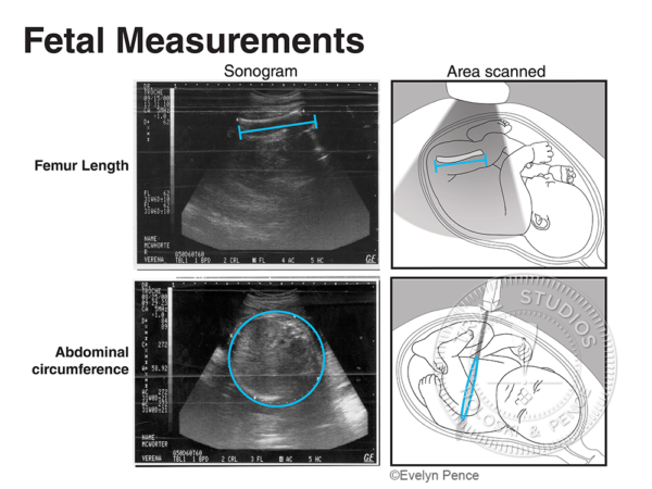 Fetal ultrasound illustration showing two fetal measurements—femur length and abdominal circumference. Each measurement pairs an ultrasound image with a corresponding anatomical diagram indicating the area scanned and measurement location.