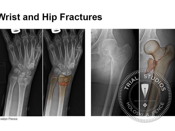 x-rays of a fractured wrist and a fractured hip interpreted with color illustrations.