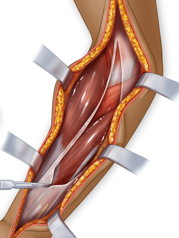 arm