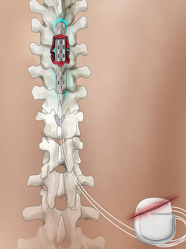 spine